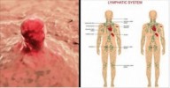 Sistema linfático doente permite que o câncer se espalhe - estas são as 9 maneiras de evitar isso!