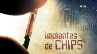 Implantes de chips de tornam populares na República Checa